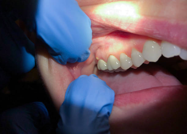 Best Emergency Cosmetic Dentistry in Stro Valley, CA